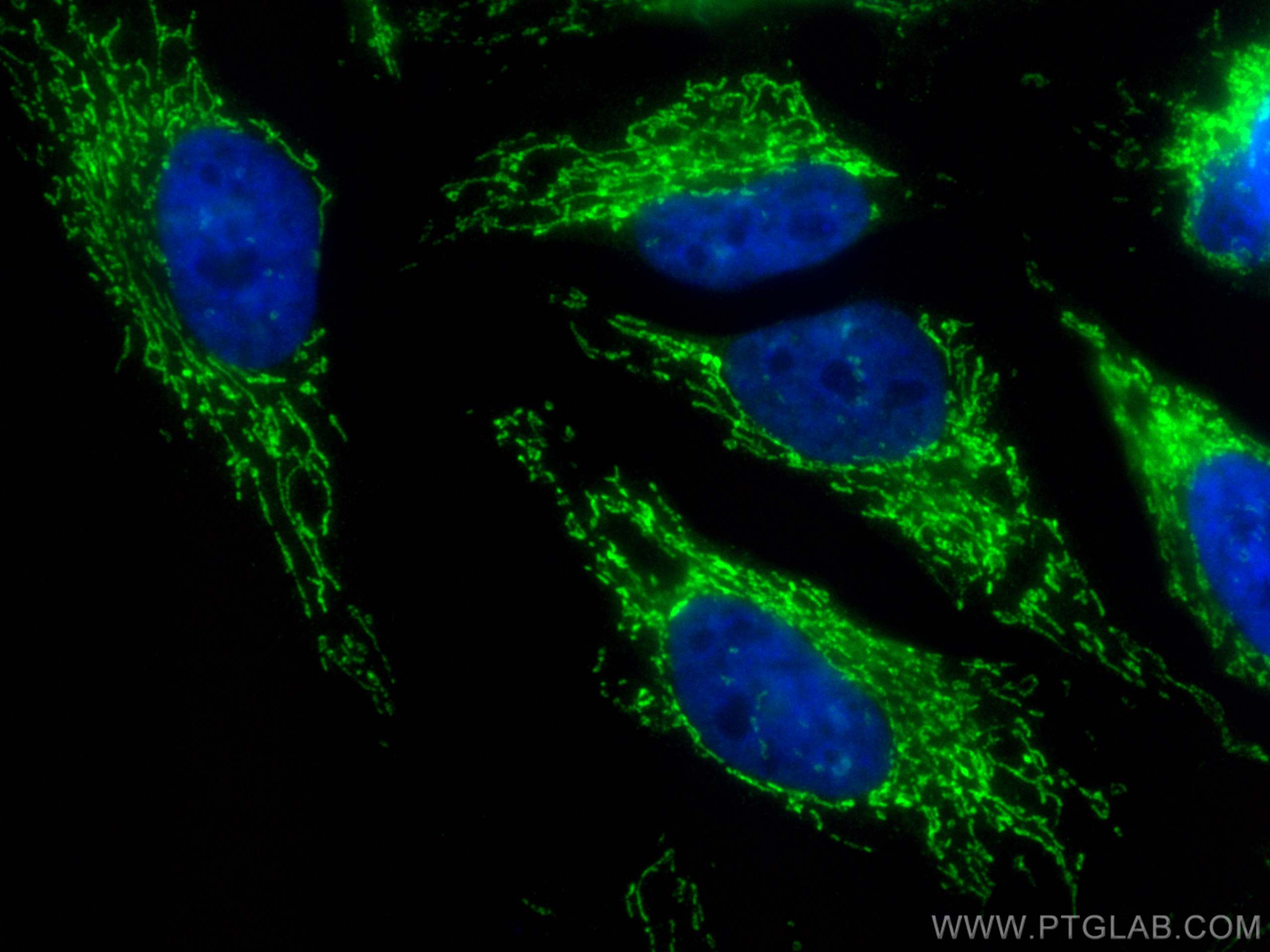 IF Staining of HeLa using CL488-81011