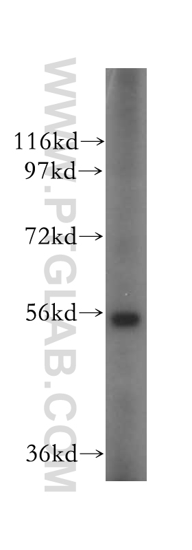 OXCT2 Polyclonal antibody