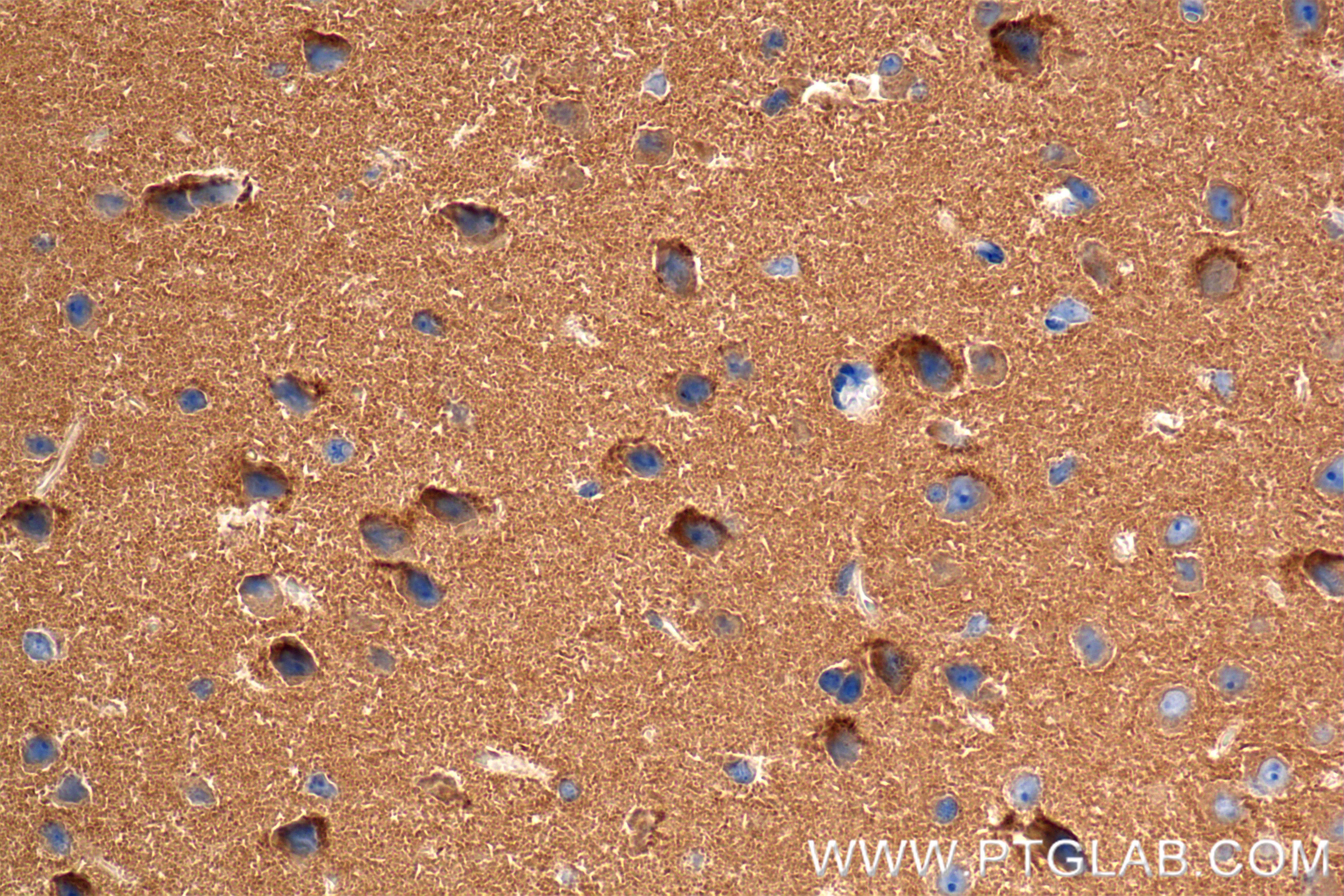 Immunohistochemical analysis of paraffin-embedded mouse brain tissue slide using 86359-3-RR (OXR1 antibody) at dilution of 1:600 (under 40x lens). Heat mediated antigen retrieval with Tris-EDTA buffer (pH 9.0). IHC staining of mouse brain using 86359-3-RR