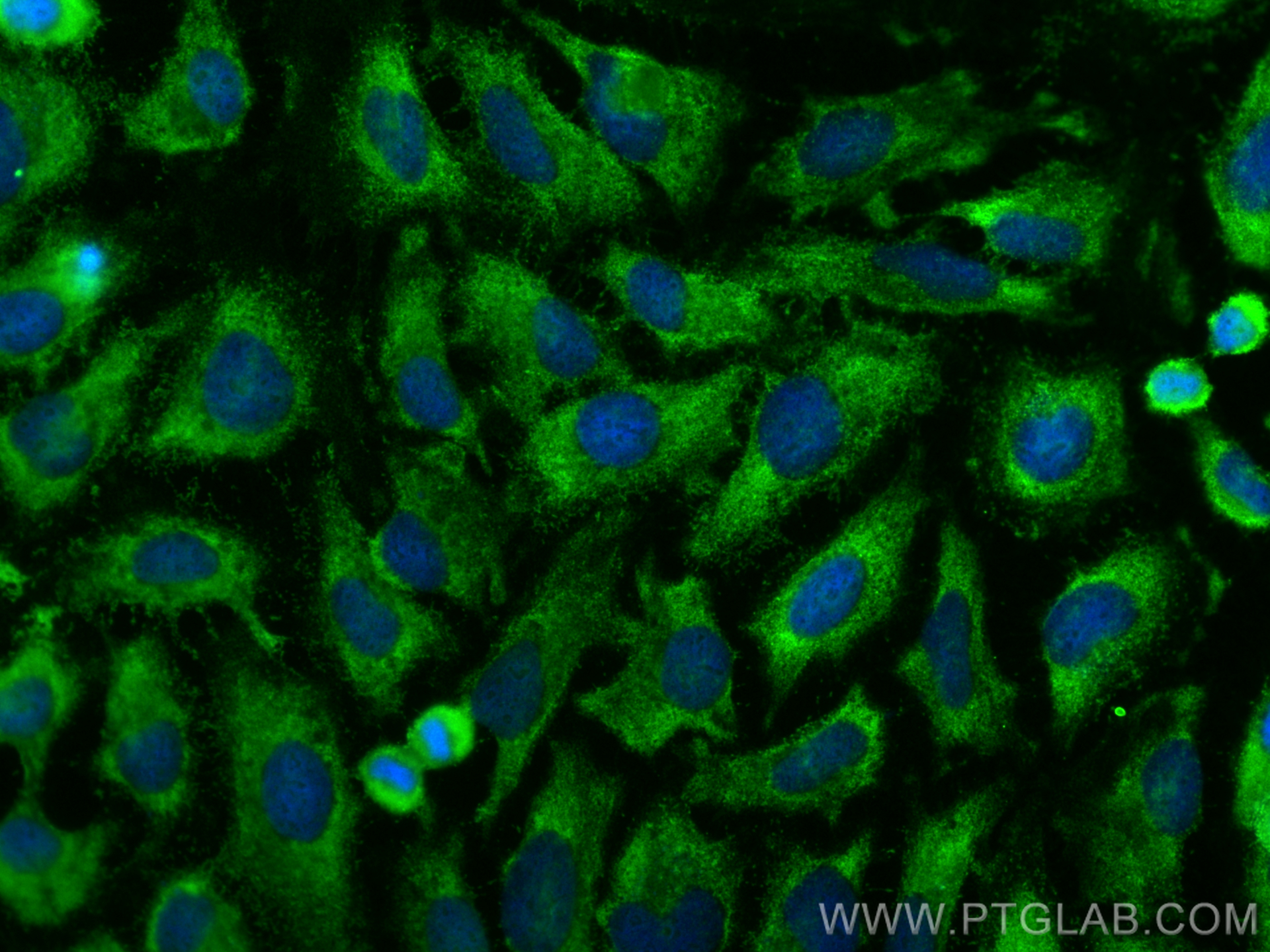 IF Staining of HeLa using 23045-1-AP