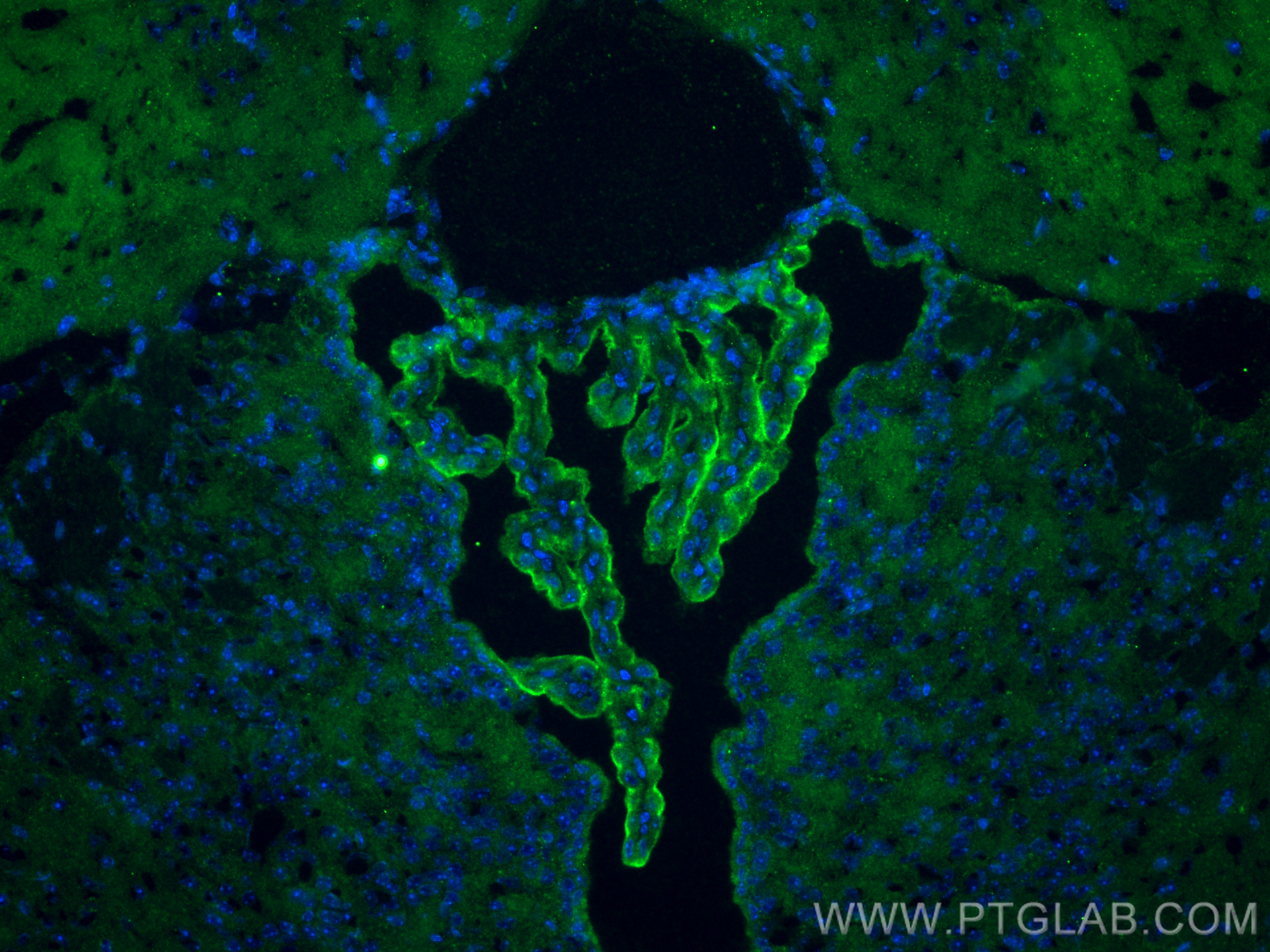 IF Staining of mouse brain using 27260-1-AP