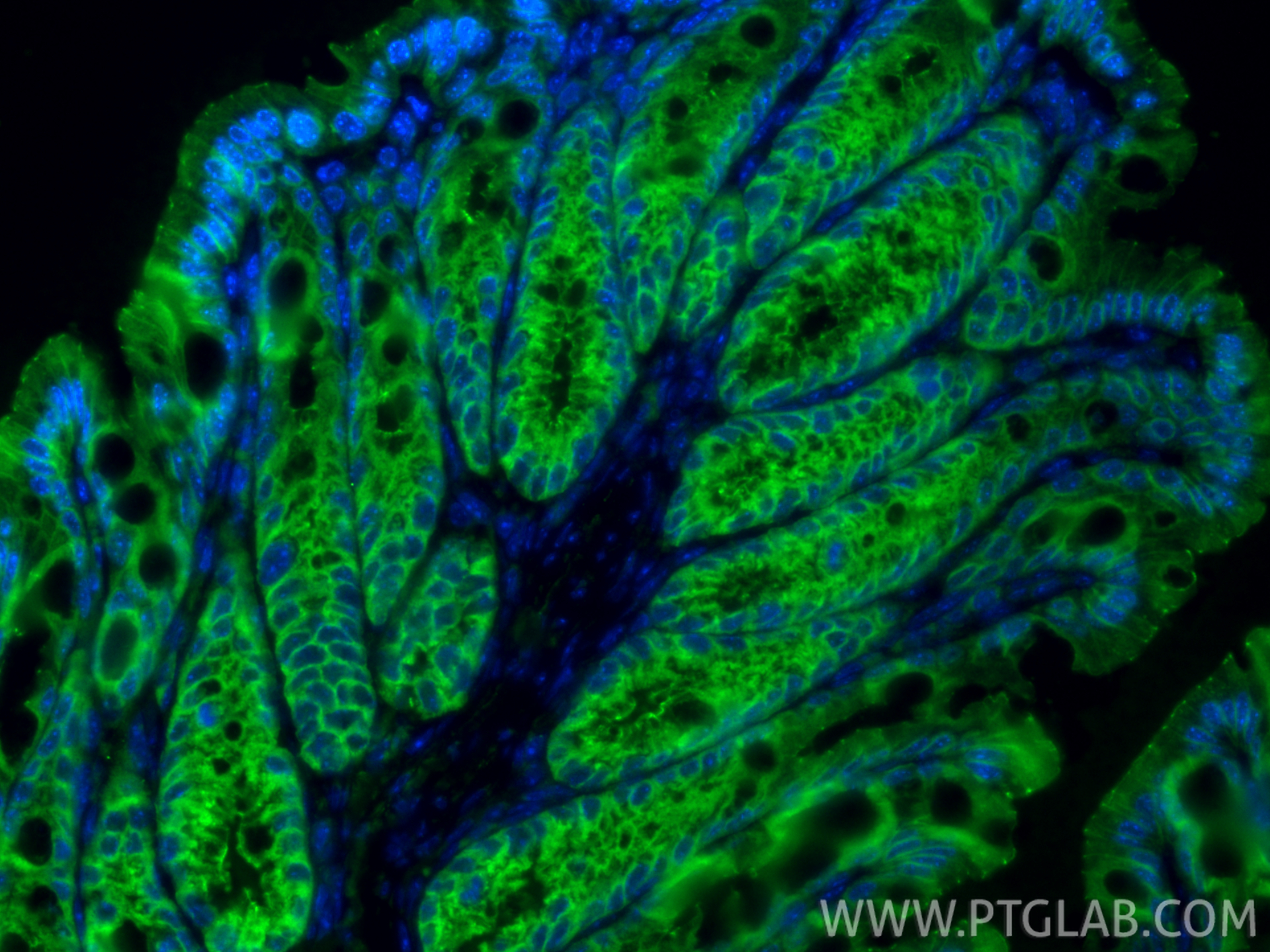 IF Staining of mouse colon using 27260-1-AP IF Staining of mouse colon using 27260-1-AP