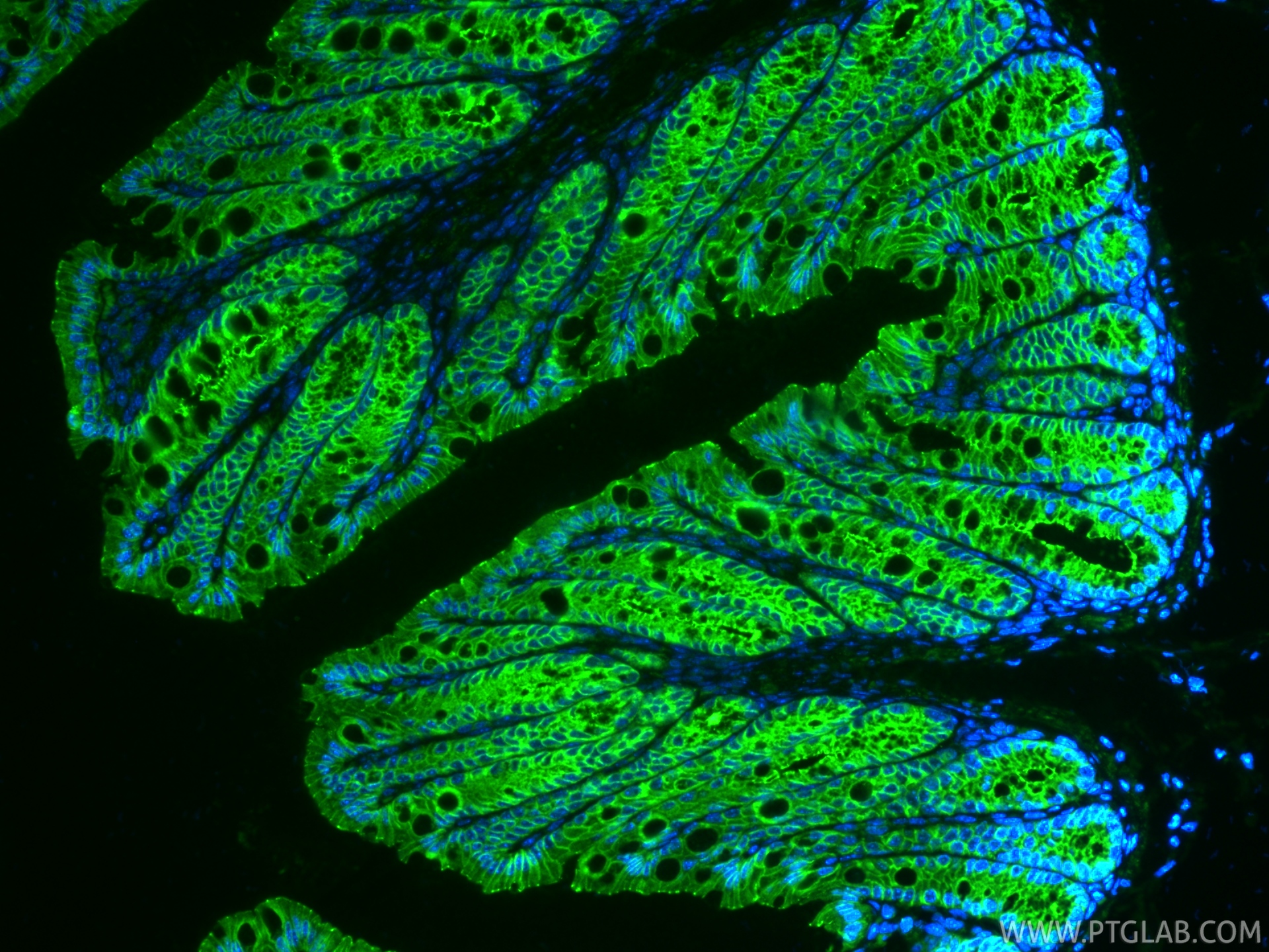 IF Staining of mouse colon using 27260-1-AP IF Staining of mouse colon using 27260-1-AP