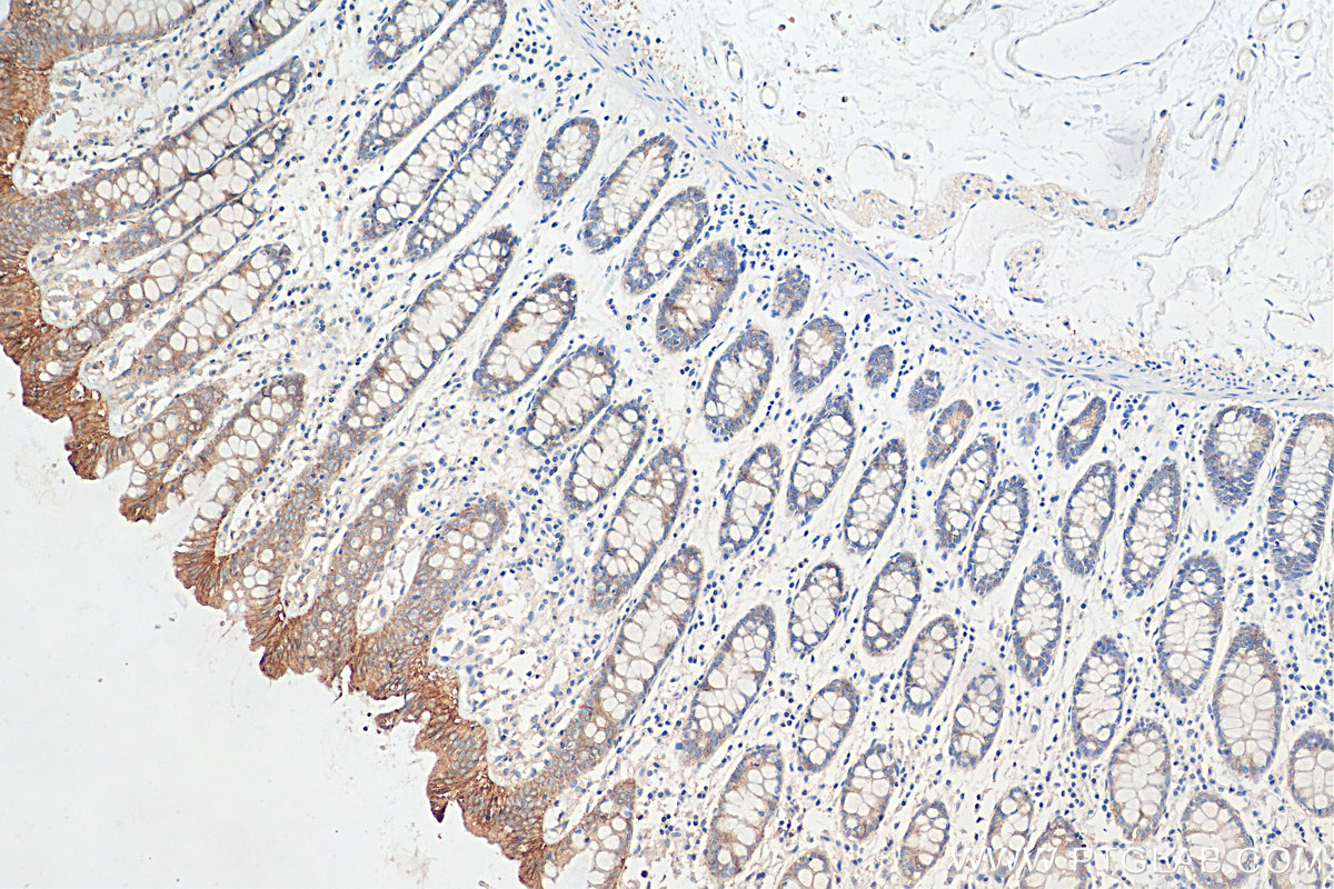 IHC staining of human colon using 27260-1-AP