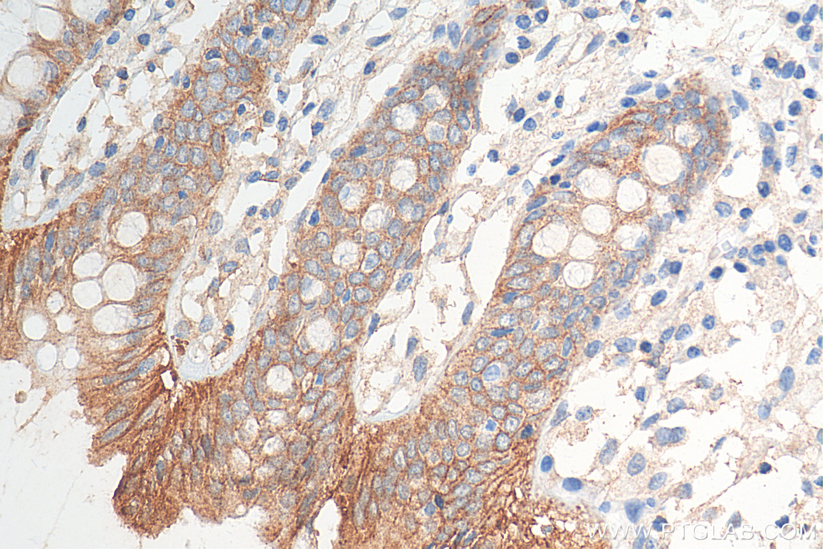 IHC staining of human colon using 27260-1-AP