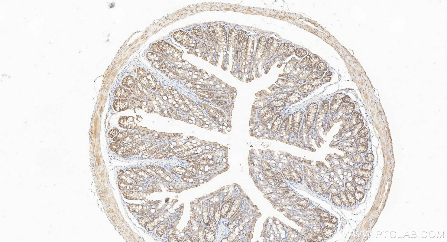 IHC staining of mouse colon using 27260-1-AP IHC staining of mouse colon using 27260-1-AP