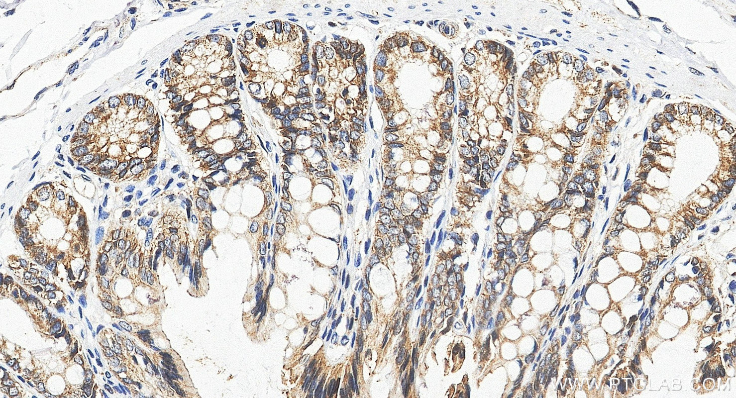IHC staining of rat colon using 27260-1-AP IHC staining of rat colon using 27260-1-AP