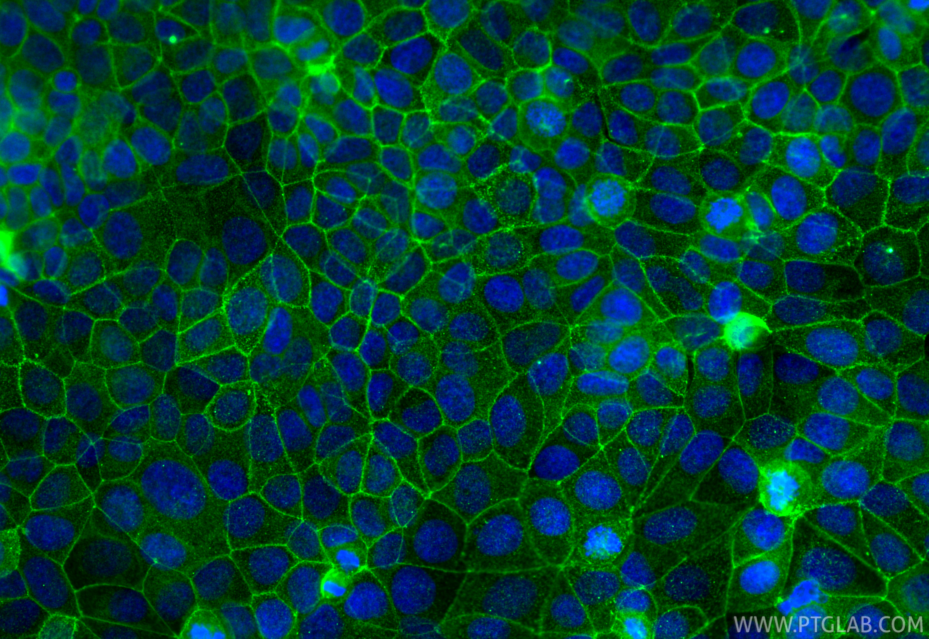 IF Staining of MCF-7 using 66378-1-Ig IF Staining of MCF-7 using 66378-1-Ig