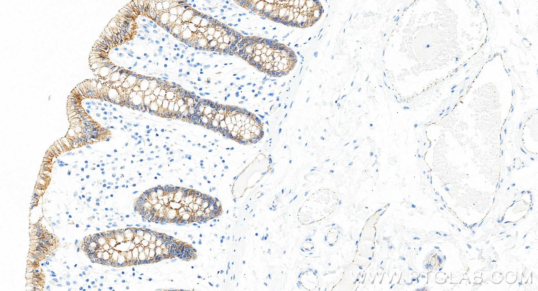 IHC staining of human colon using 80545-1-RR