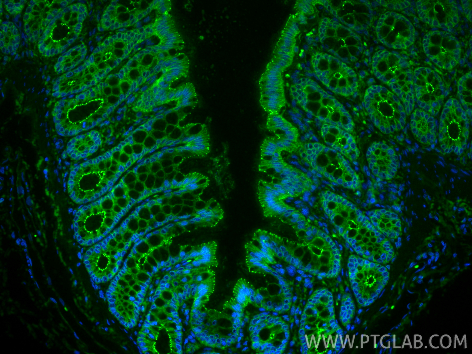 IF Staining of rat colon using 80545-1-RR