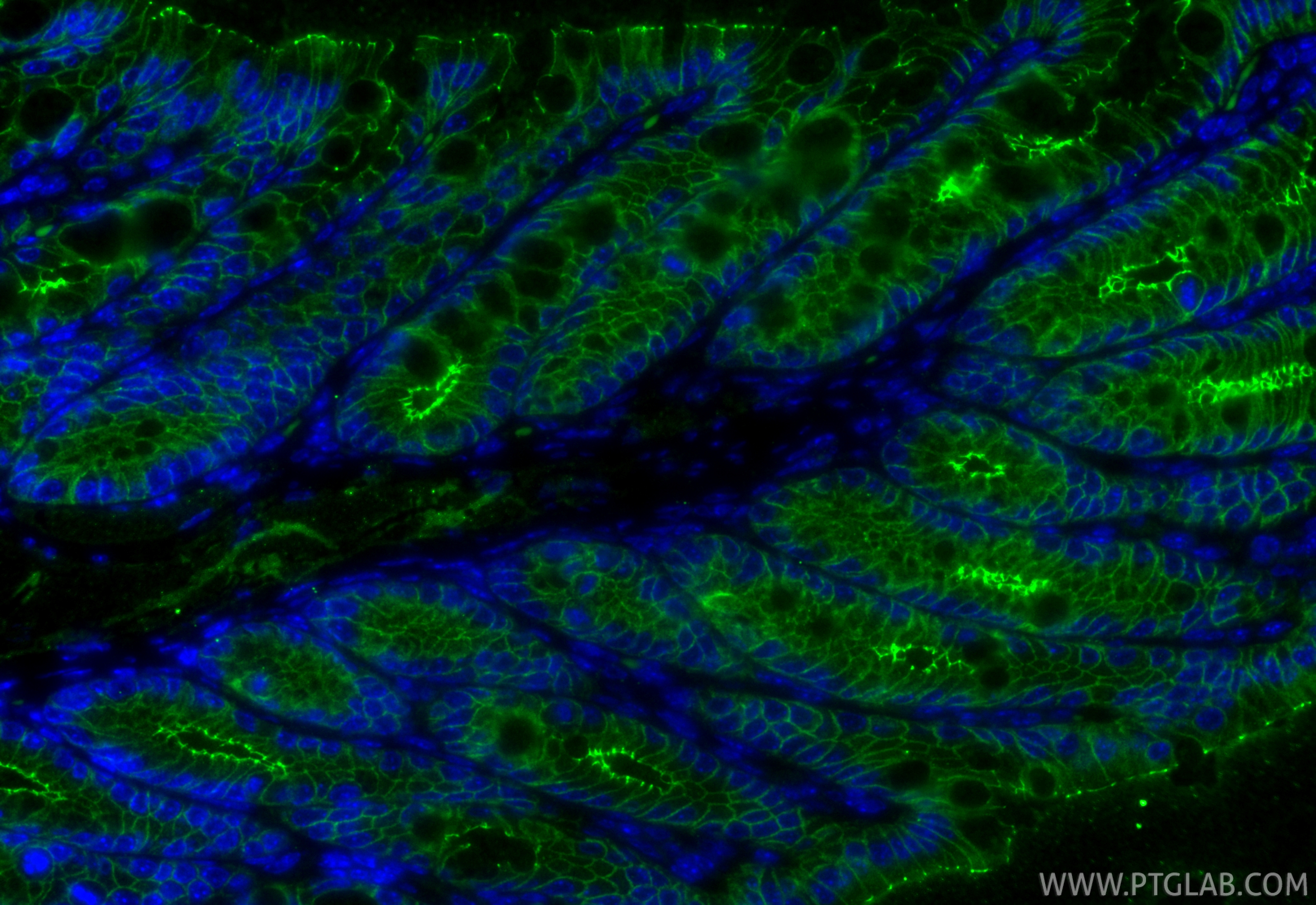 IF Staining of mouse colon using 80545-1-RR