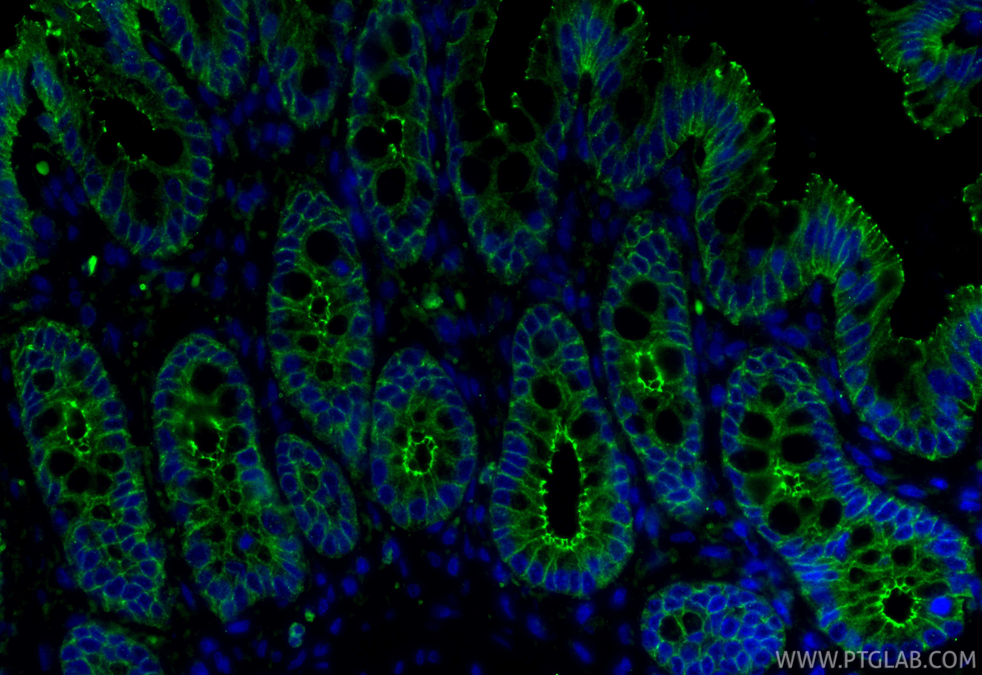 IF Staining of rat colon using 80545-1-RR