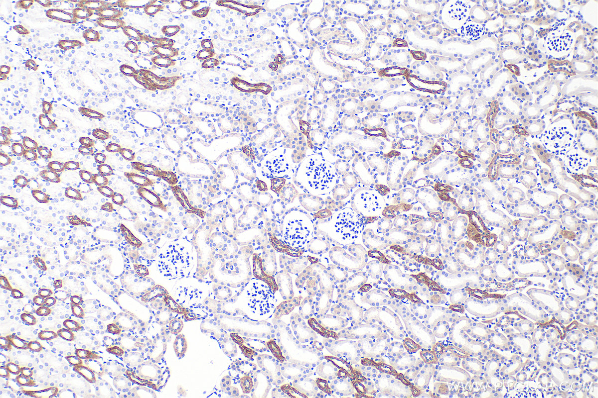 IHC staining of mouse kidney using 80545-1-RR IHC staining of mouse kidney using 80545-1-RR
