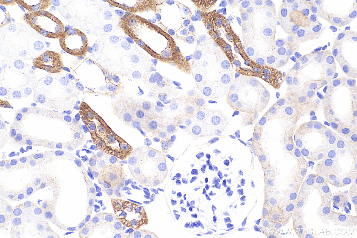 IHC staining of mouse kidney using 80545-1-RR IHC staining of mouse kidney using 80545-1-RR