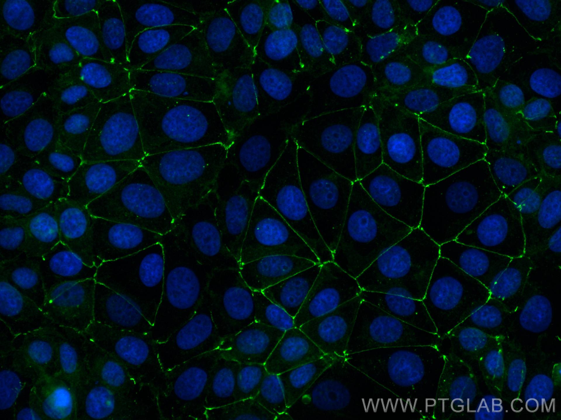 IF Staining of MCF-7 using CL488-13409