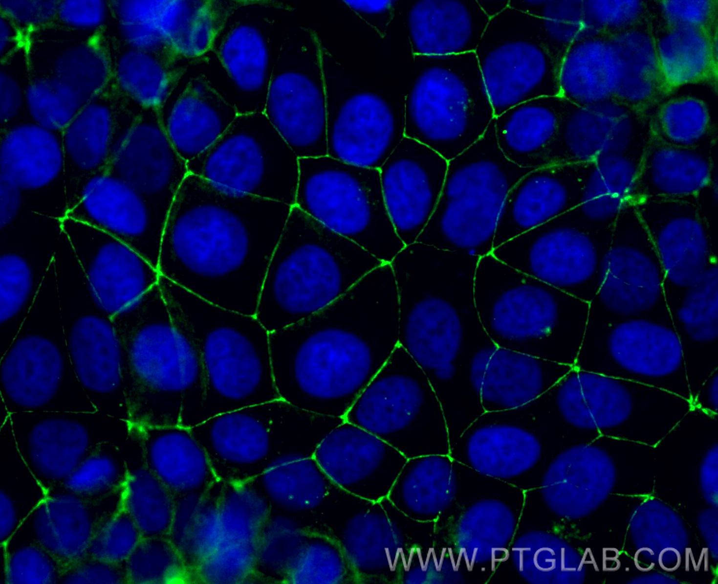 IF Staining of MCF-7 using CL488-27260