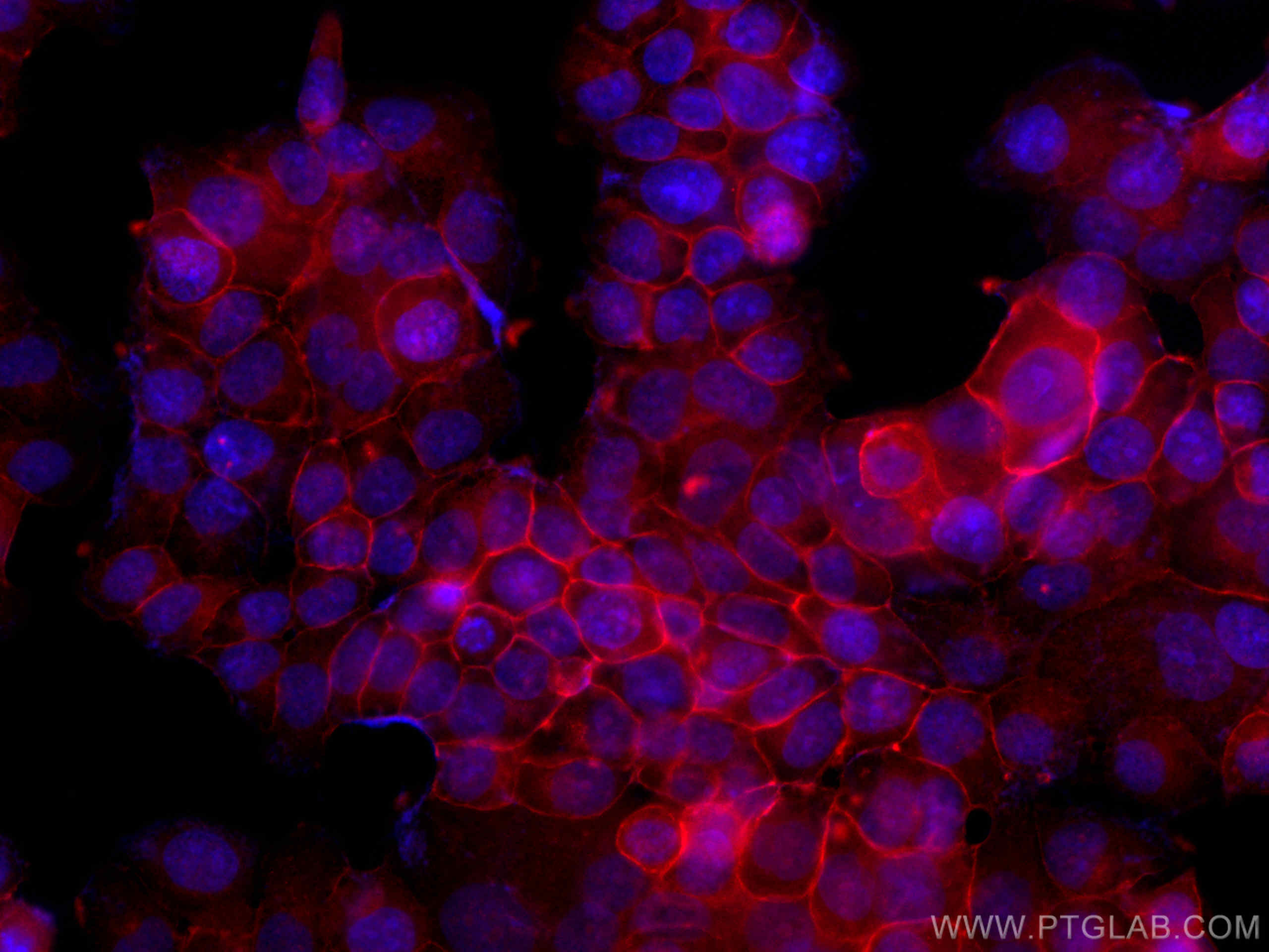 IF Staining of T-47D using CL594-13409