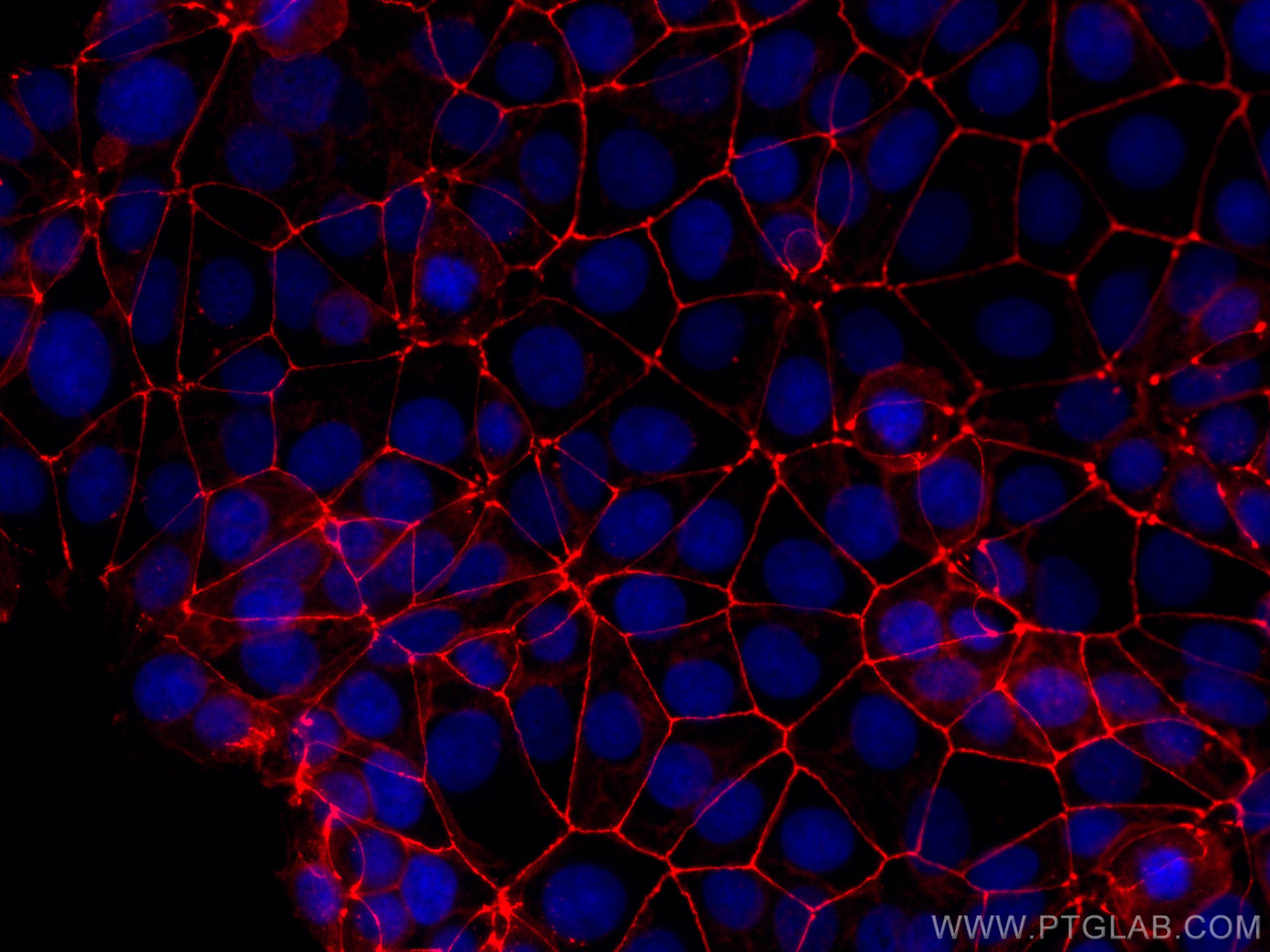 IF Staining of MCF-7 using CL594-27260