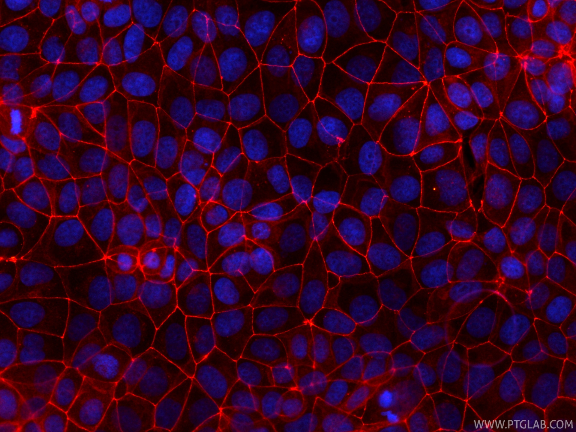 IF Staining of MCF-7 using CL594-80545