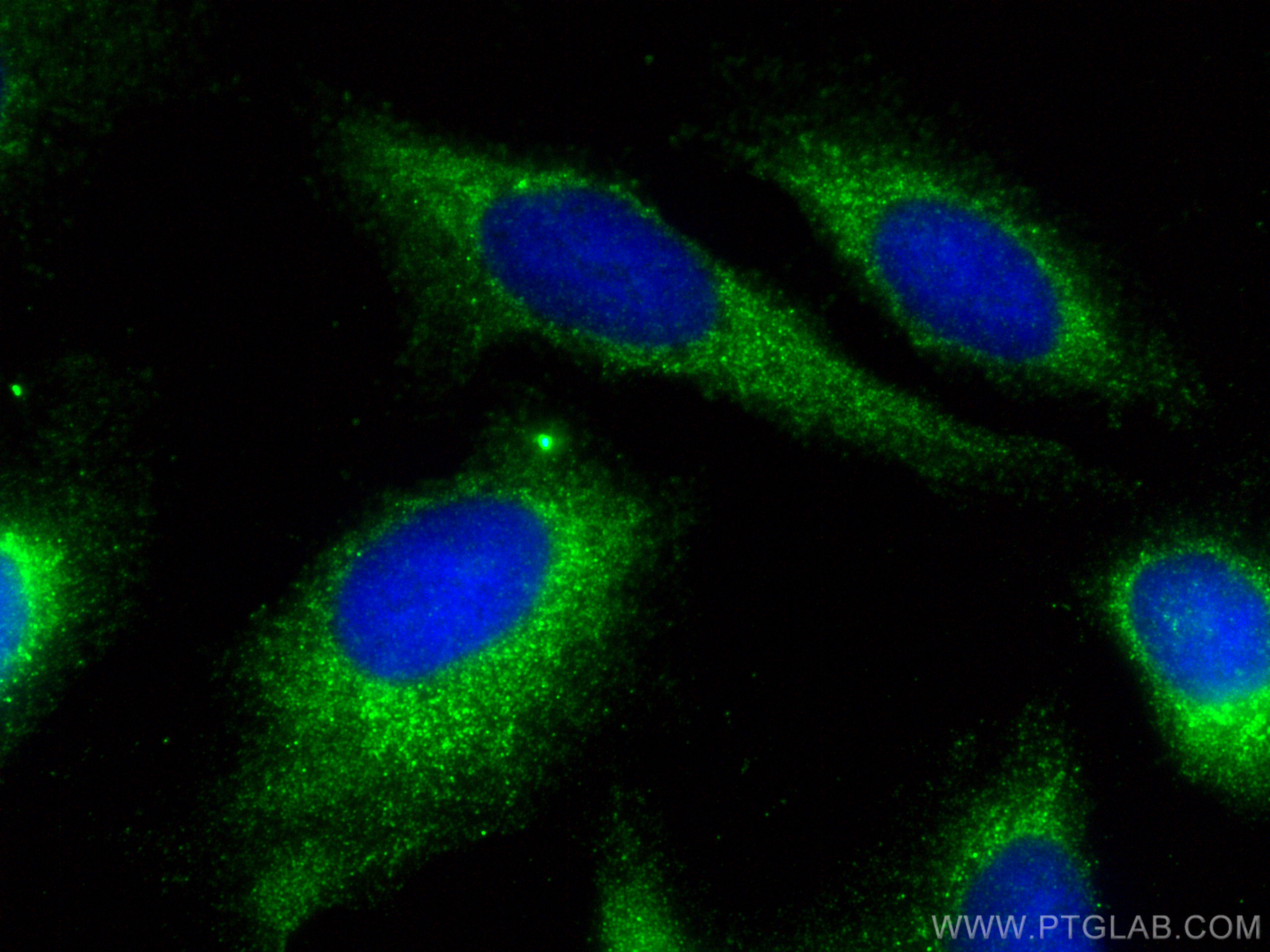 IF Staining of U2OS using 23418-1-AP