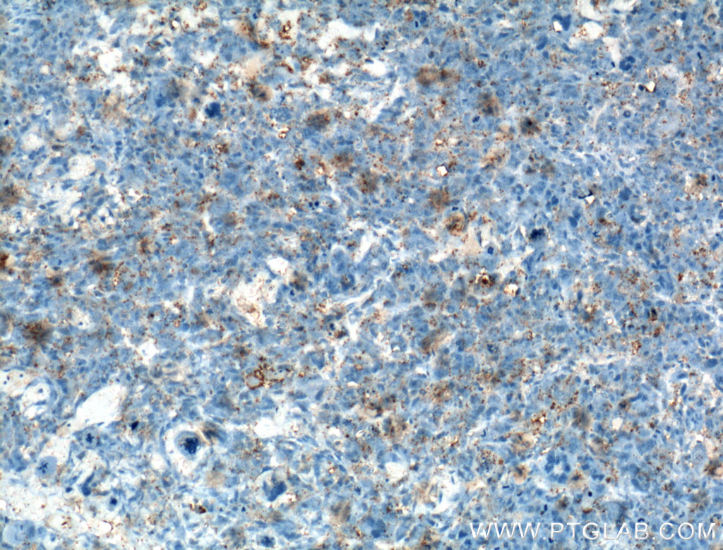 Osteocalcin Polyclonal antibody