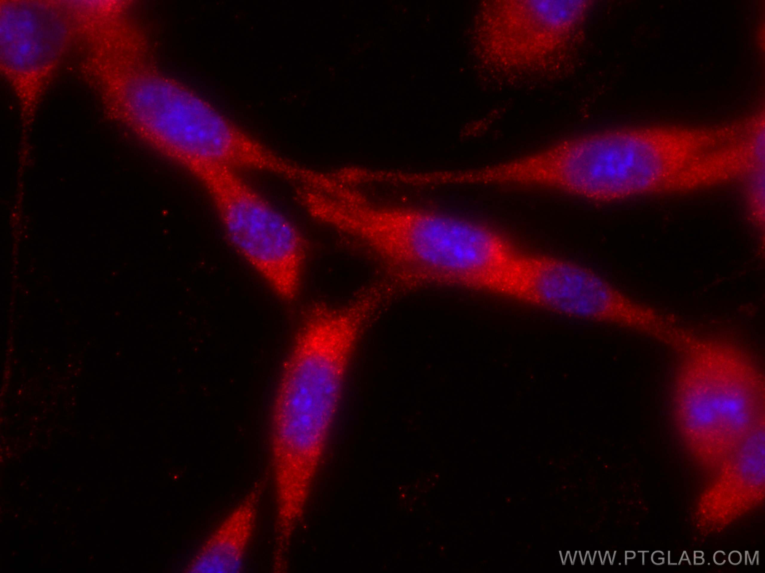 IF Staining of NIH/3T3 using CL594-23418