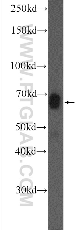 WB analysis of mouse kidney using 25715-1-AP