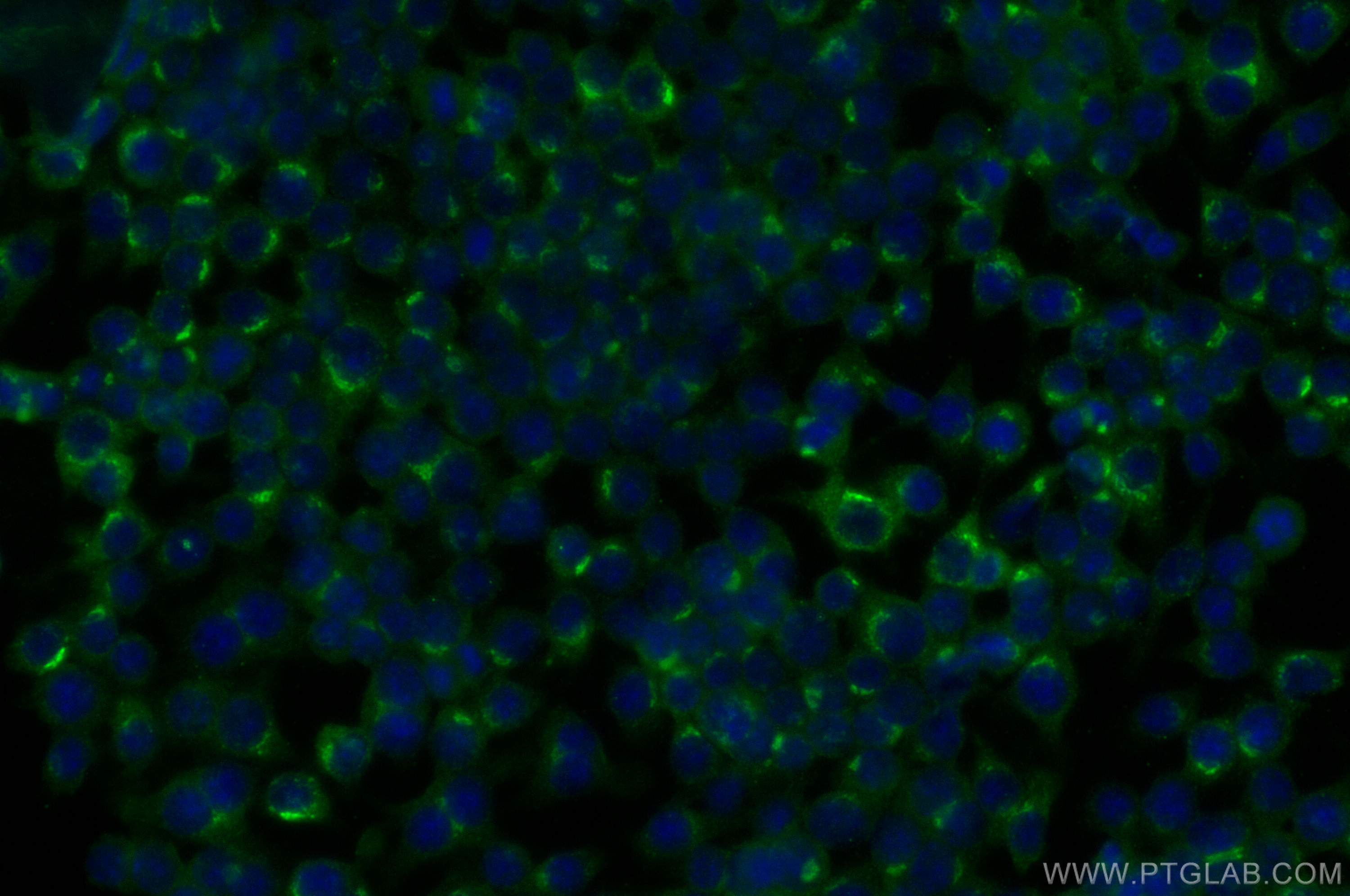 IF Staining of RAW 264.7 using 30200-1-AP