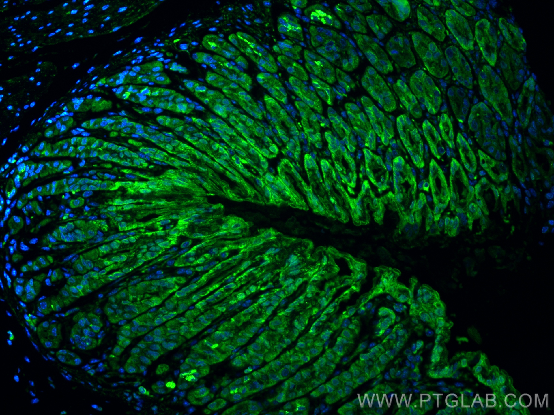 IF Staining of mouse stomach using 83413-6-RR