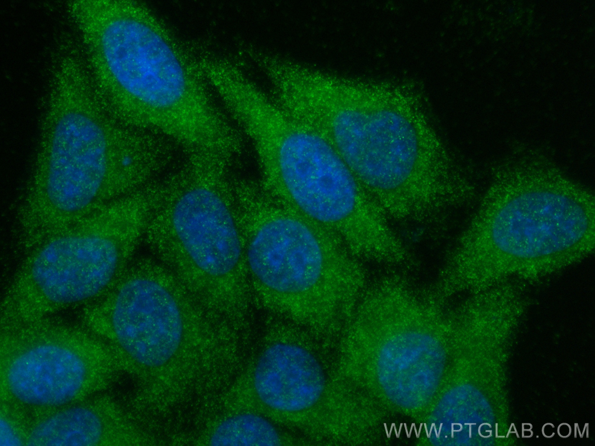 IF Staining of HepG2 using 31766-1-AP
