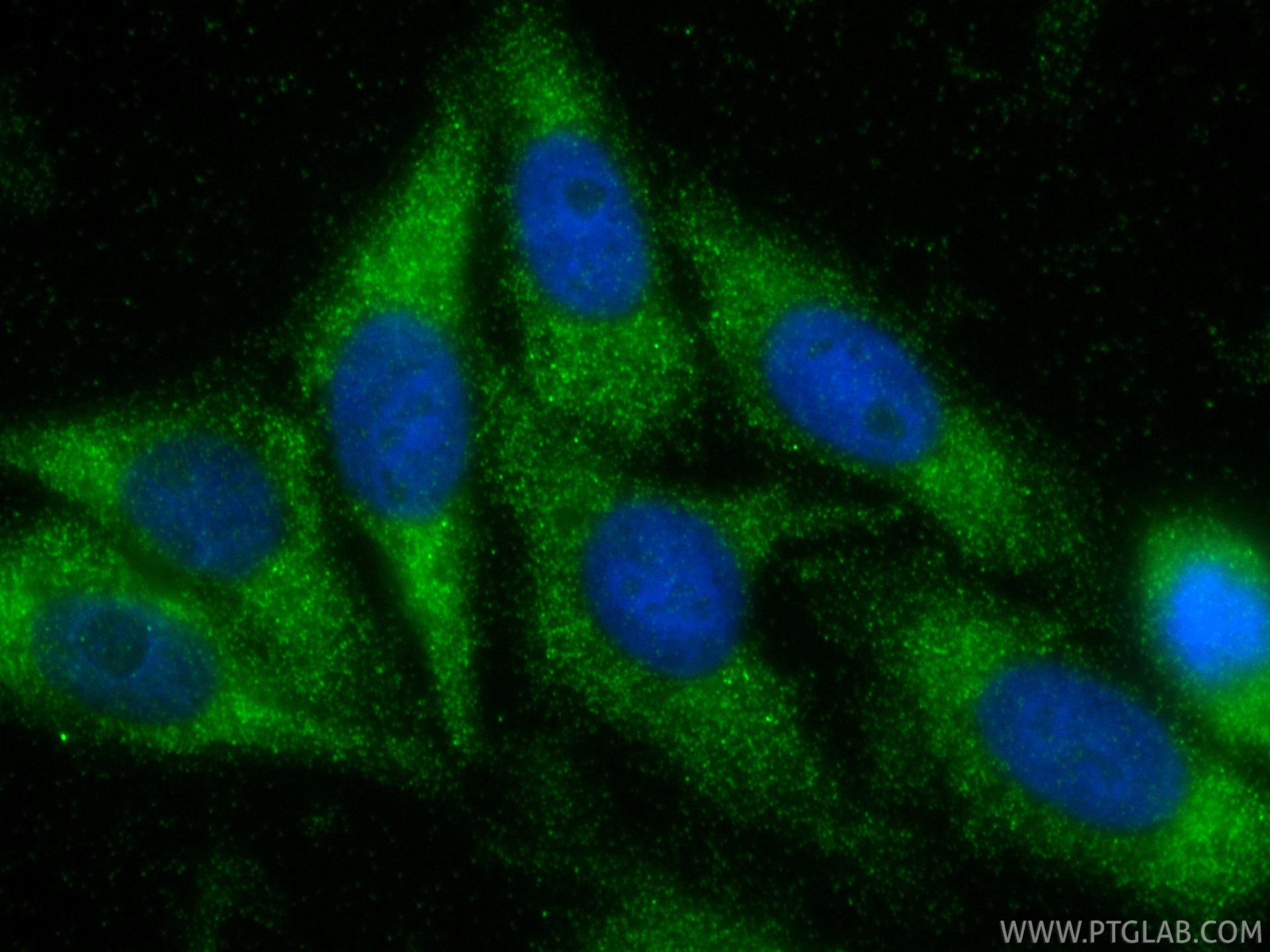 IF Staining of HepG2 using 31766-1-AP IF Staining of HepG2 using 31766-1-AP