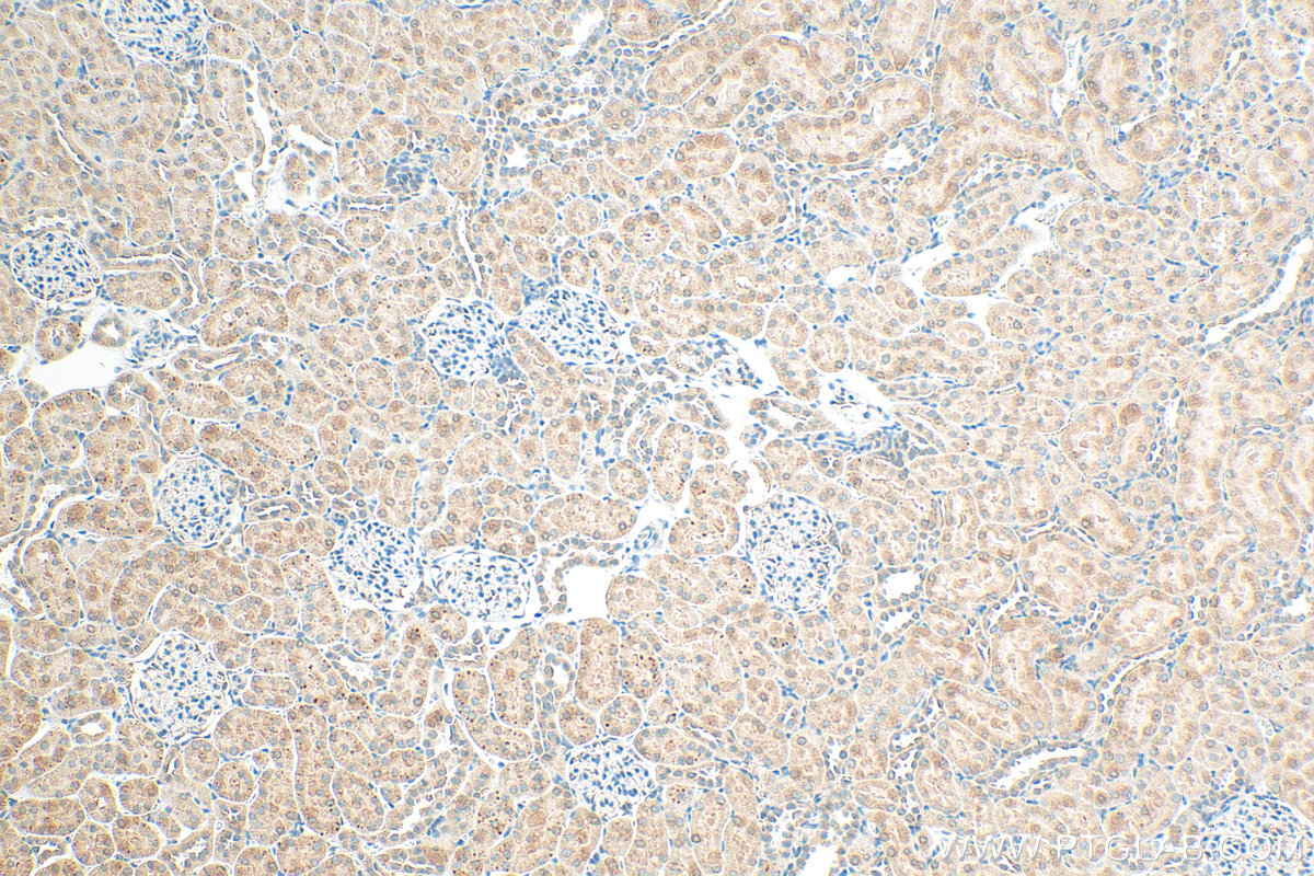 IHC staining of rat kidney using 31766-1-AP