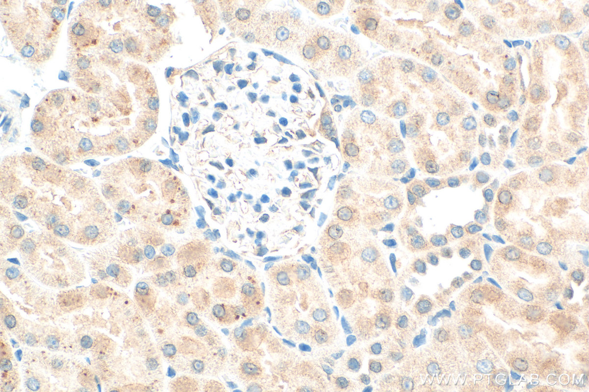 IHC staining of rat kidney using 31766-1-AP