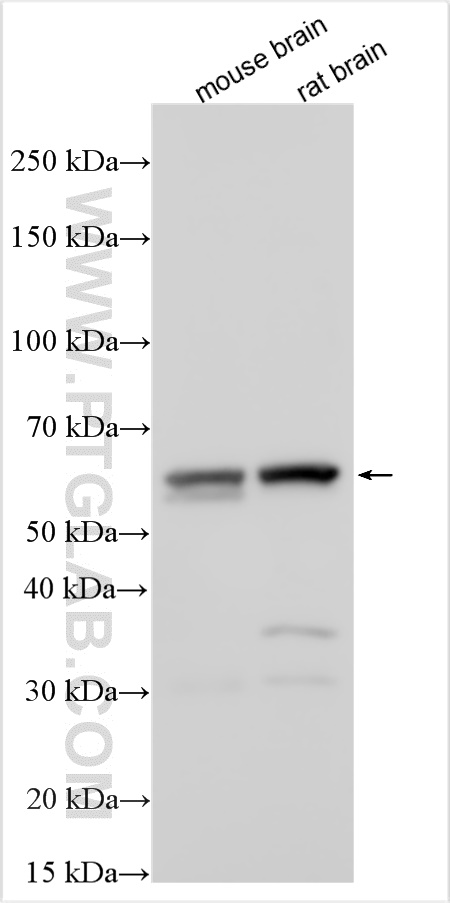 Osteoprotegerin/TNFRSF11B