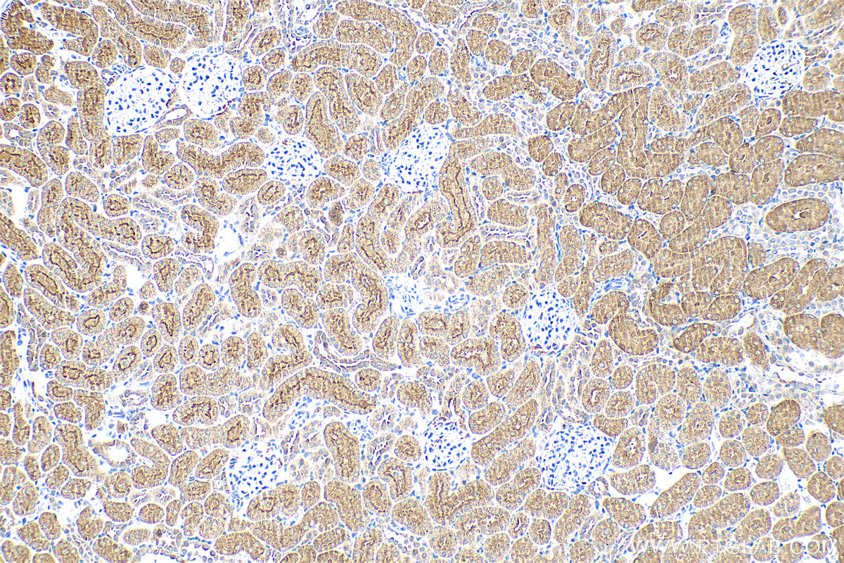 IHC staining of rat kidney using 83506-1-RR (same clone as 83506-1-PBS)