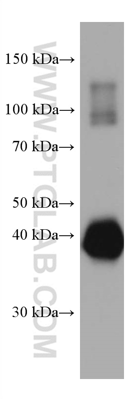 WB analysis of Recombinant protein using 67614-1-Ig (same clone as 67614-1-PBS)