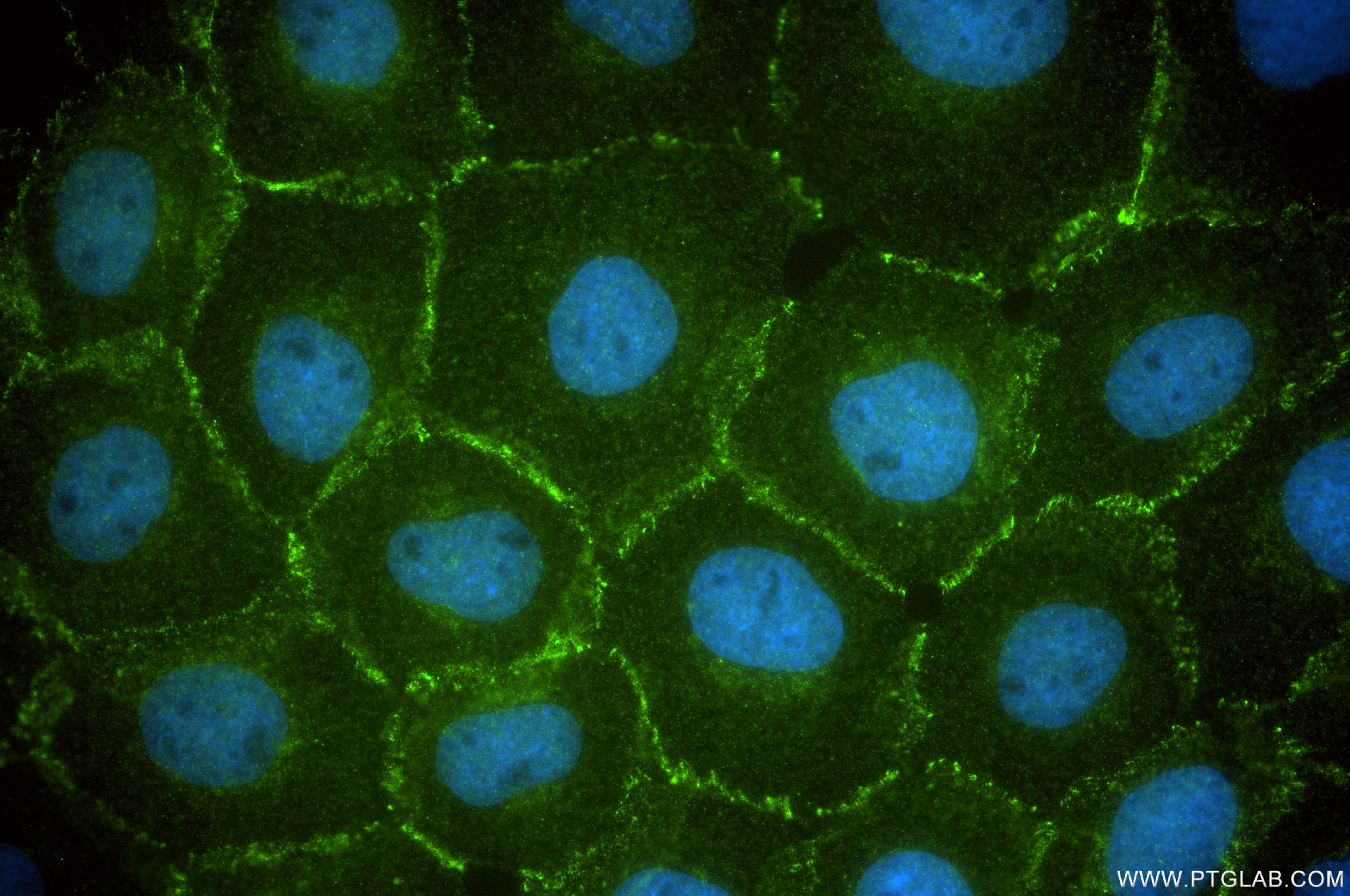 IF Staining of A431 using 86776-1-RR IF Staining of A431 using 86776-1-RR