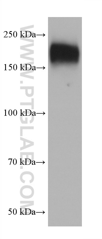 WB analysis of SH-SY5Y using 67258-2-Ig