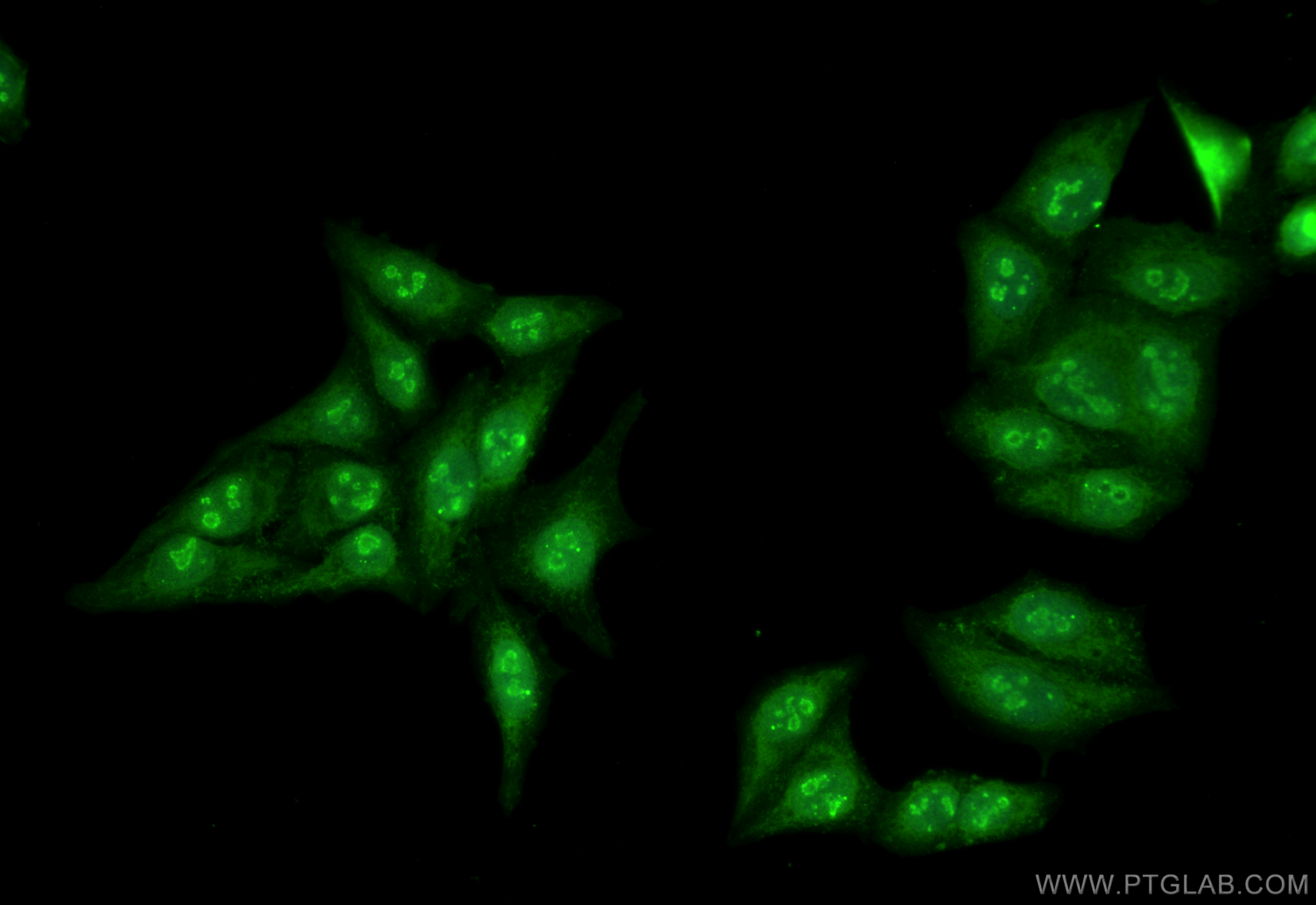IF Staining of HepG2 using 11815-1-AP