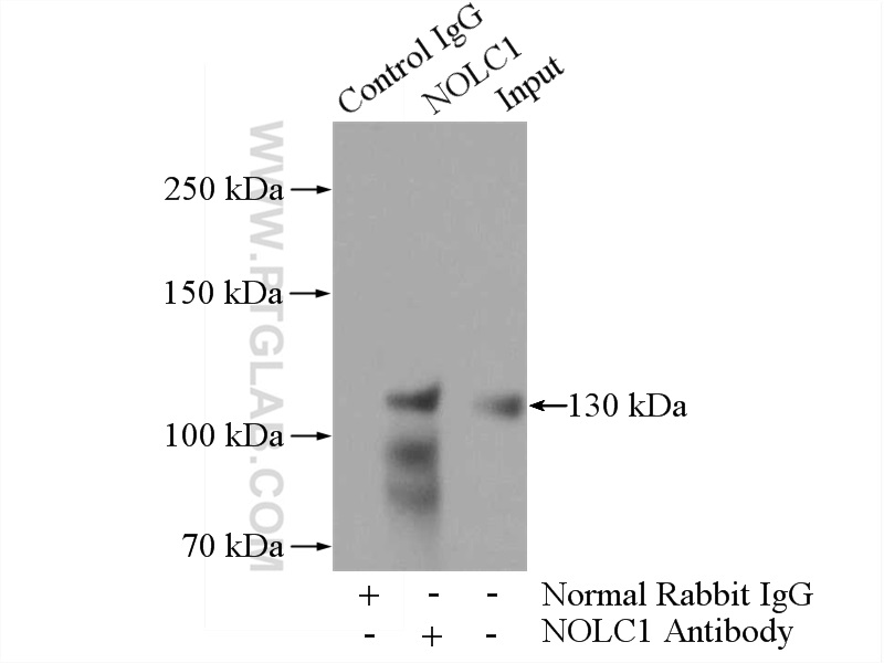 IP experiment of HeLa using 11815-1-AP