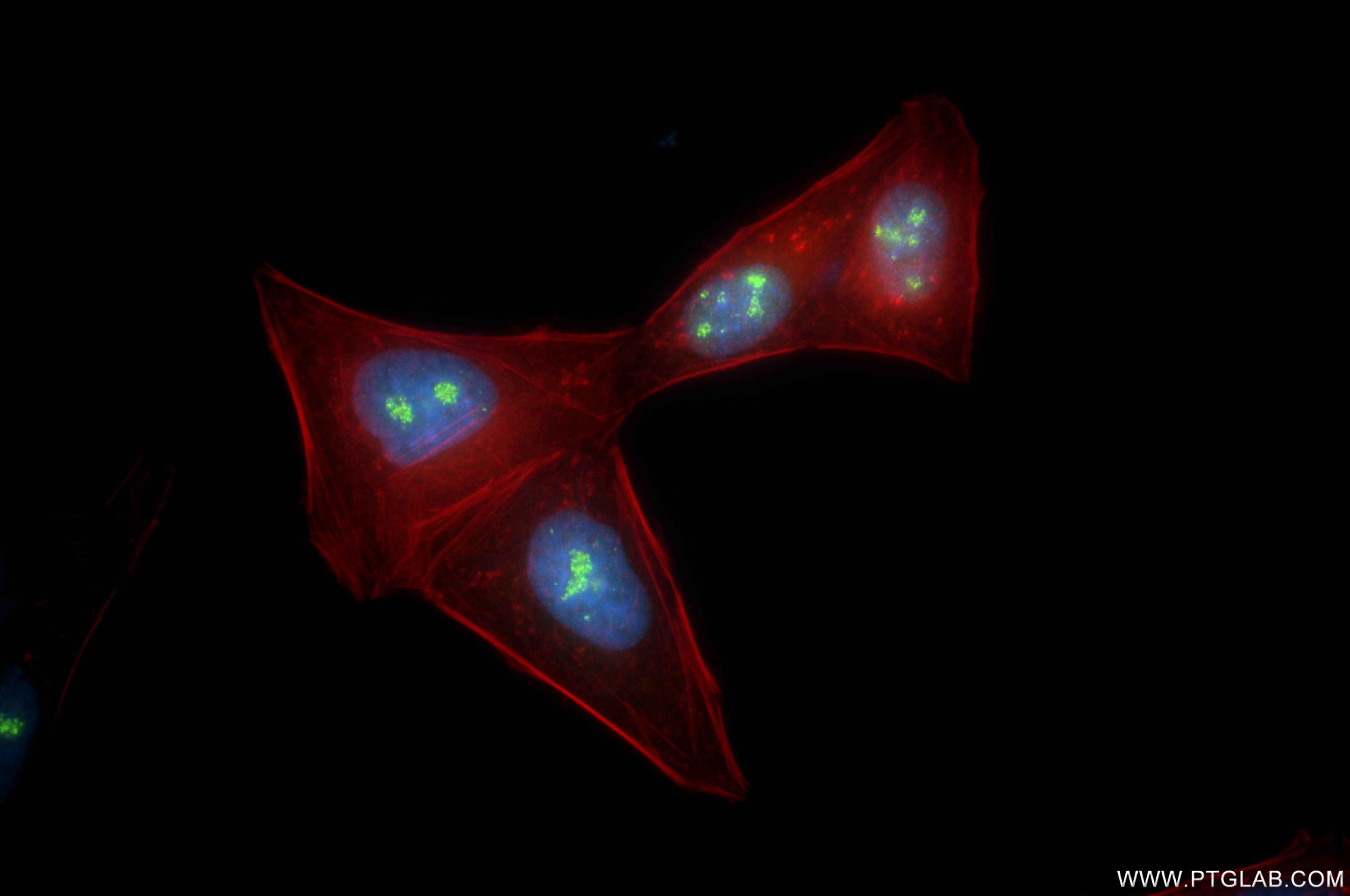 IF Staining of HepG2 using 87016-1-RR