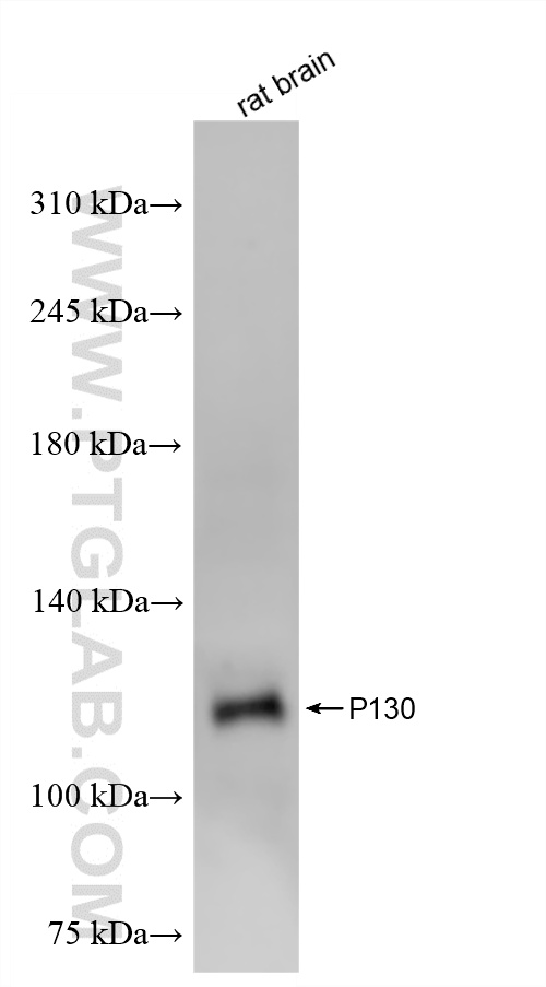 WB analysis of rat brain using 87016-1-RR