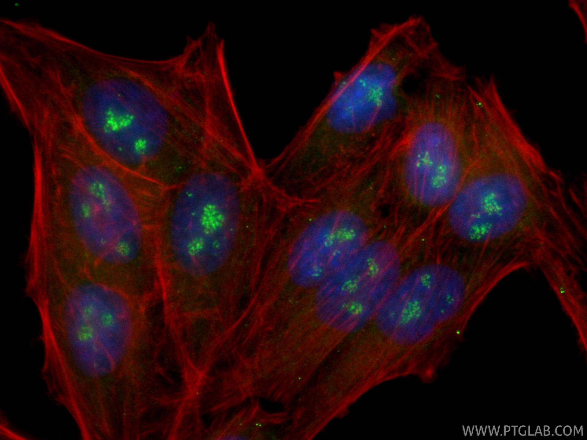 IF Staining of HepG2 using CL488-87016