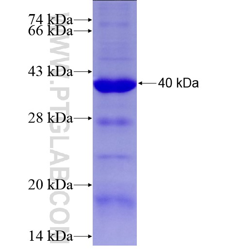 P130 fusion protein Ag28262 SDS-PAGE