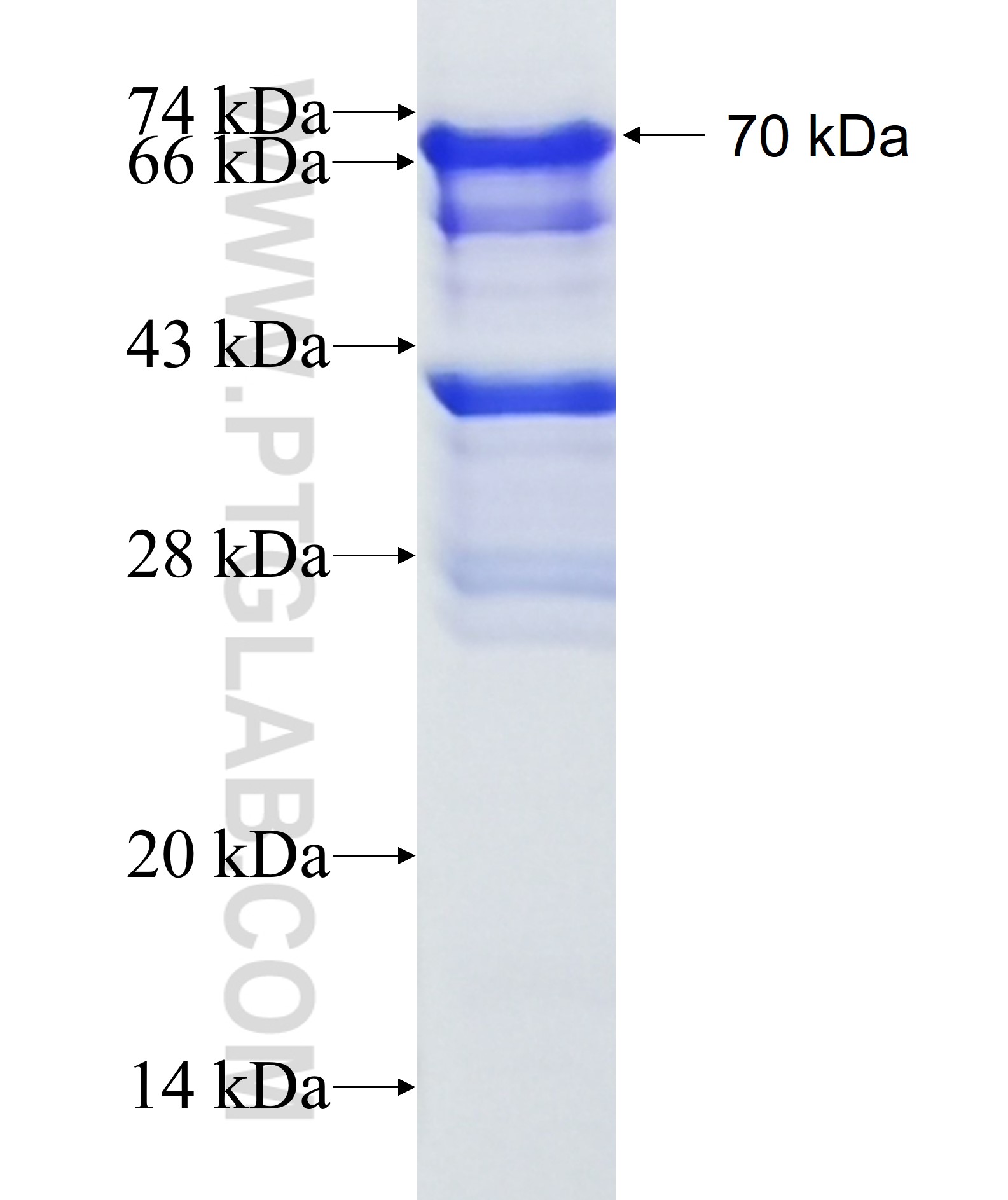 P130 fusion protein Ag2382 SDS-PAGE