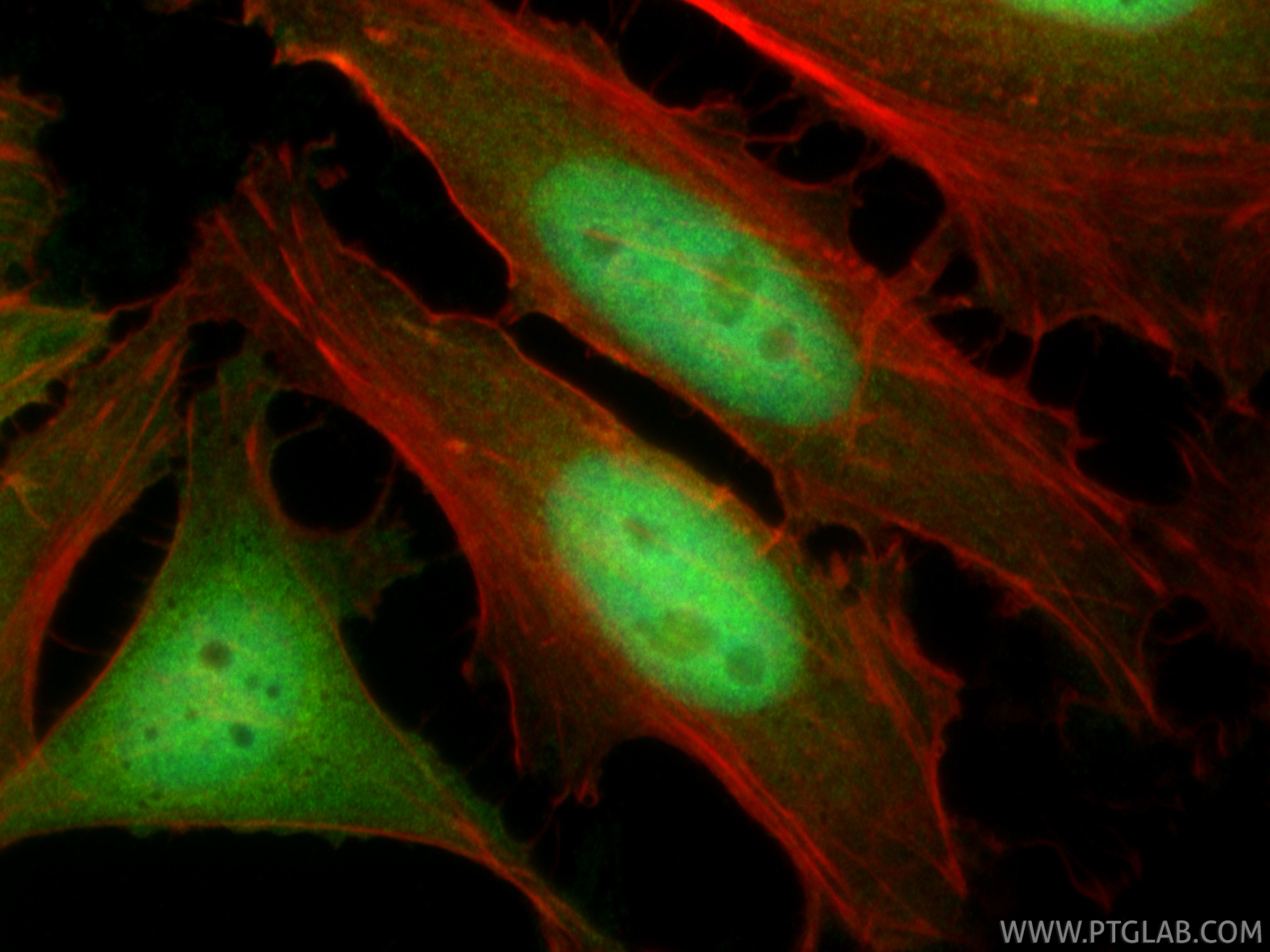 IF Staining of HeLa using 10883-1-AP IF Staining of HeLa using 10883-1-AP