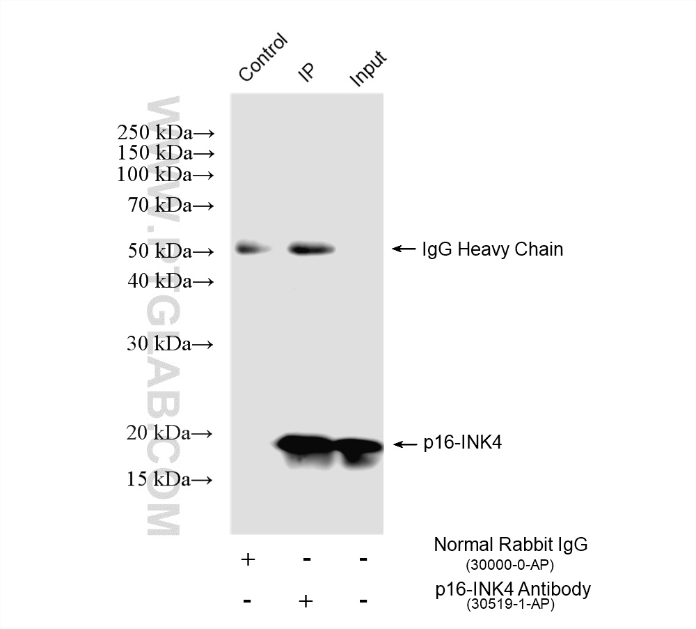 IP experiment of HEK-293 using 30519-1-AP
