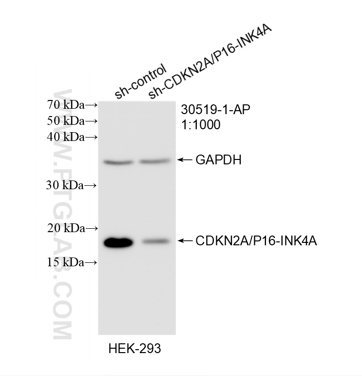 WB result of CDKN2A/P16-INK4A antibody (30519-1-AP; 1:1000; incubated at room temperature for 1.5 hours) with sh-Control and sh-CDKN2A/P16-INK4A transfected HEK-293 cells. WB analysis of HEK-293 using 30519-1-AP