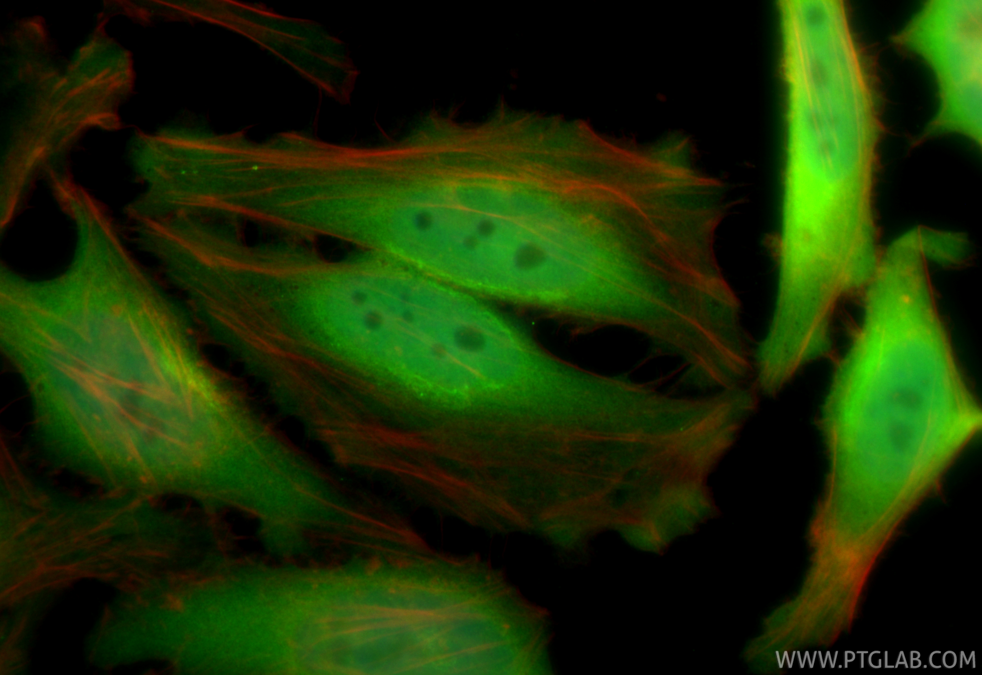 Immunofluorescent analysis of (4% PFA) fixed HeLa cells using CDKN2A/P16-INK4A antibody (81373-10-RR, Clone: 241438B2 ) at dilution of 1:400 and CoraLite®488-Conjugated Goat Anti-Rabbit IgG(H+L) (<a class='green' href='/productredirect?CatalogNo=SA00013-2' target='_blank'>SA00013-2</a>), CL594-Phalloidin (red). IF Staining of HeLa using 81373-10-RR