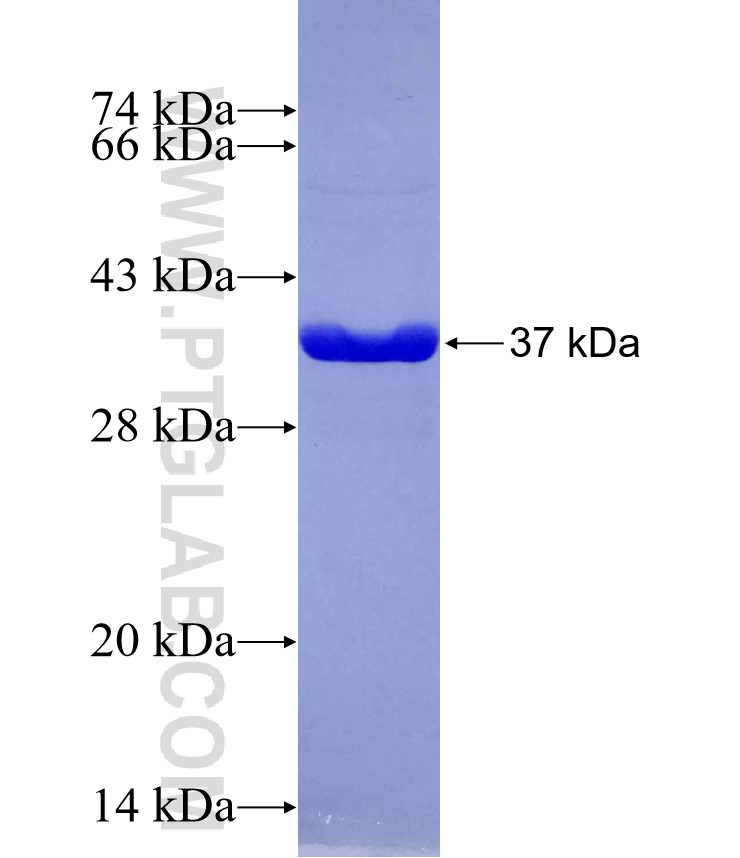 P16-INK4A fusion protein Ag29567 SDS-PAGE
